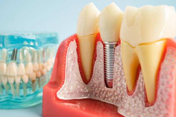 Best Dental Exams and Cleanings  in North Randall, OH